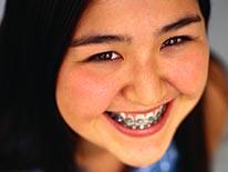 Picture of a smiling female student with braises on her teeth